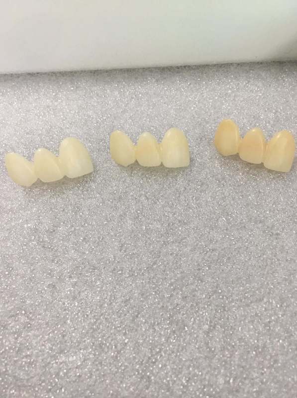 3D Plus Multilayer 43% -57% 6 Layers 3D Zirconia Dental Block Disc CAD CAM 89mm System for Dental Lab with ISO CE Certificate