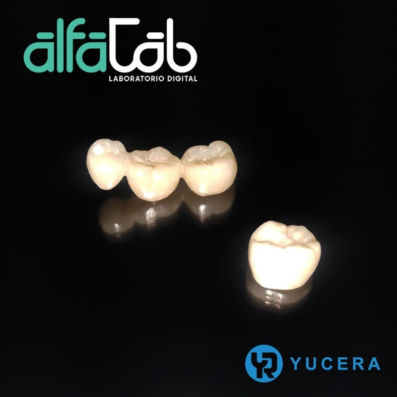 Yucera 4D Pro Super Durable Dental Zirconia Block Compatible with CAD CAM System for Precise Restoration and a Refreshed Smile
