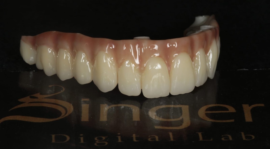 Yucera 4D Pro Zirconium Discs Reliable and Precise Dental Restoration Tools