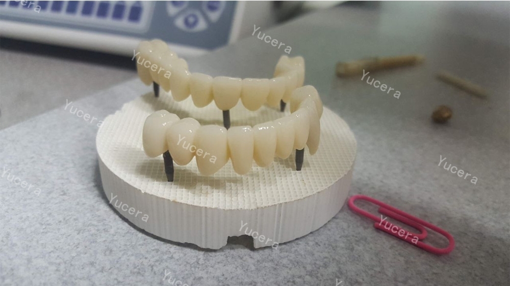 Gốm Zirconia Nha Khoa Đa Lớp Yucera 4D Pro Hệ Thống Mở 98mm cho Phòng Thí Nghiệm và Phòng Khám Nha Khoa