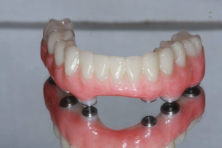 Yucera  98*22mm Dental PMMA Blocks  CADCAM Multilayer PMMA Pink Disc