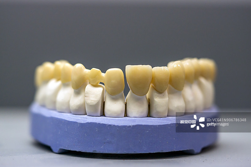 Rely on Yucera STwhite Zirconia Materials for Durable and Aesthetically Superior Dental Outcomes
