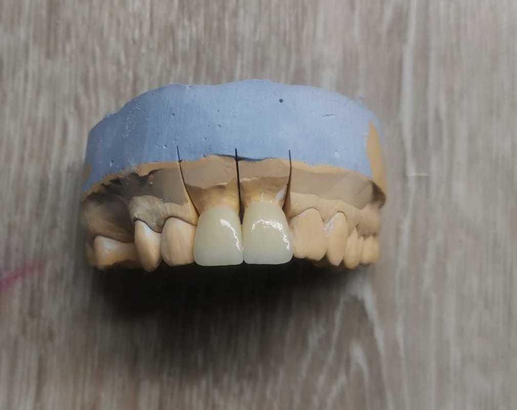 Yucera ST color Dental Zirconia Blocks - Ideal for Precise Dental Restorations