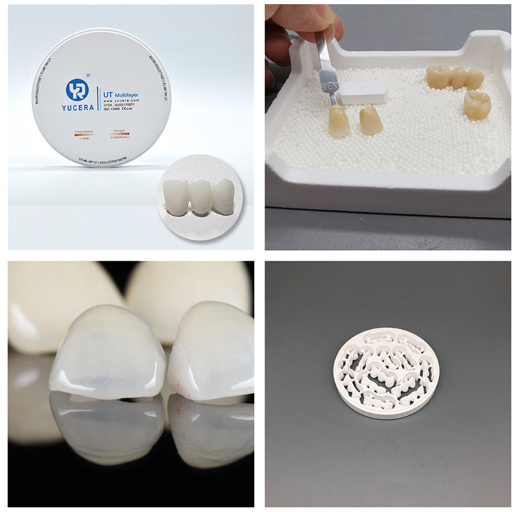 Discover the Precision of Yucera UT white Zirconia Ceramic Blocks for Dental Crowns