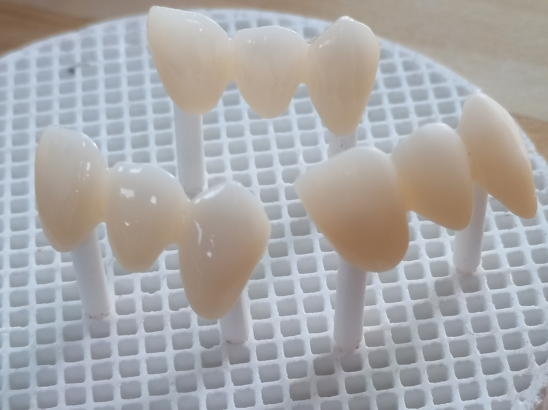 SHT Ultra Ceramic Zirconia Blocks Dental 900 MPa High Flexural Strength